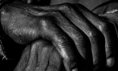 Alzheimer, une maladie encore taboue en Afrique