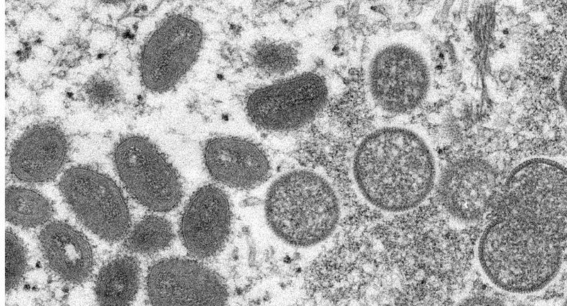 Santé en Afrique - Virus de Marburg: l'épidémie se propage en Guinée équatoriale.