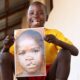 Fentes labio-palatines: à Goma, on répare le visage des enfants