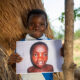 Fentes labio-palatines: à Goma, on répare le visage des enfants