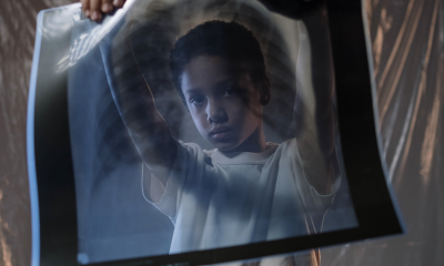 Tuberculose: comment améliorer la prévention chez les enfants