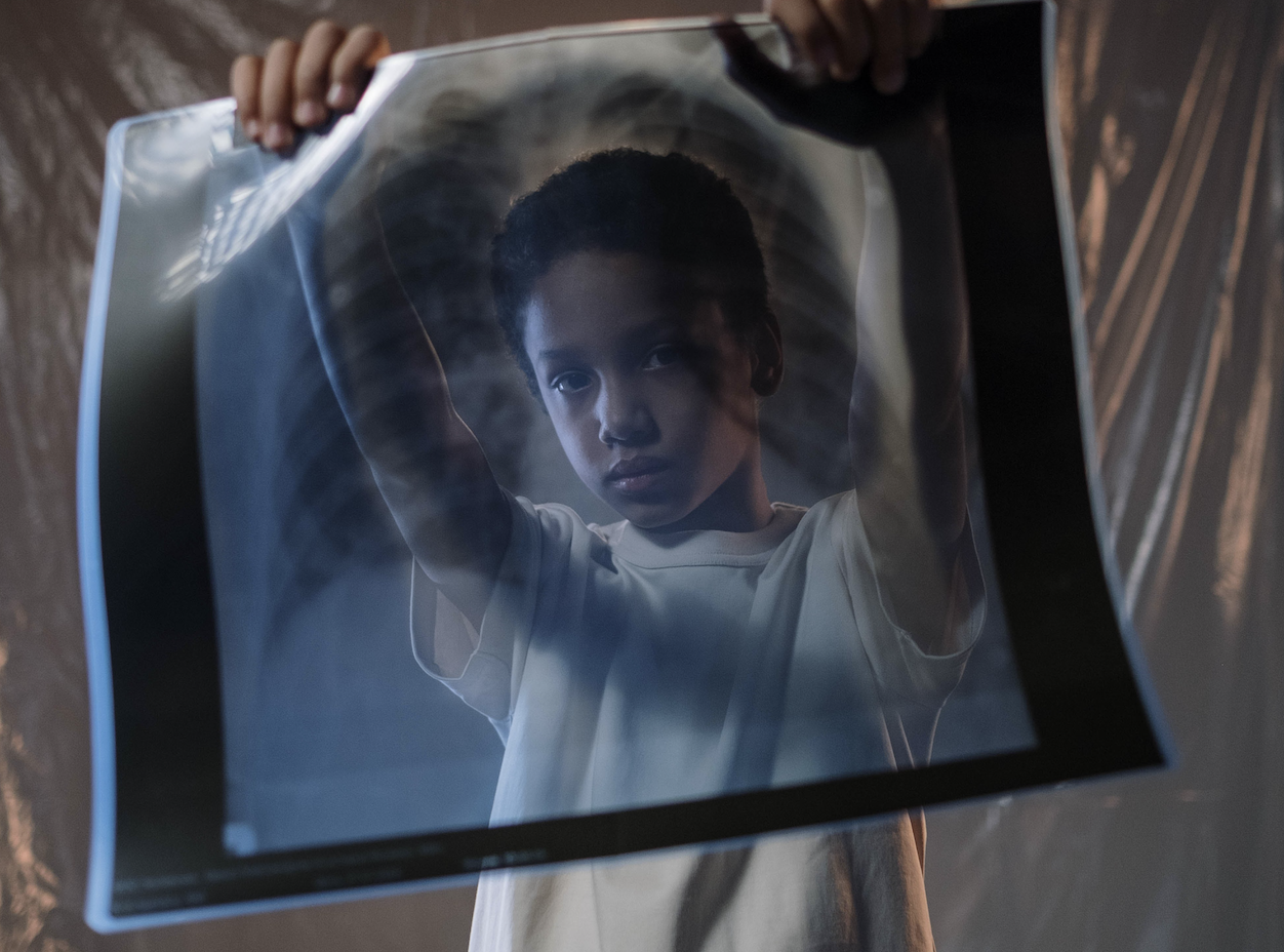 Tuberculose: comment améliorer la prévention chez les enfants